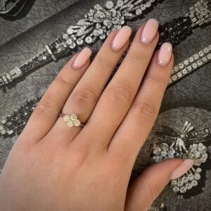 V55.4 Hand